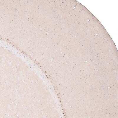 Immunohistochemistry-Paraffin: CTGF/CCN2 Antibody (CL5339) [NBP2-61415]