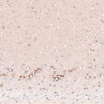 Immunohistochemistry-Paraffin: CTGF/CCN2 Antibody (CL5339) [NBP2-61415]