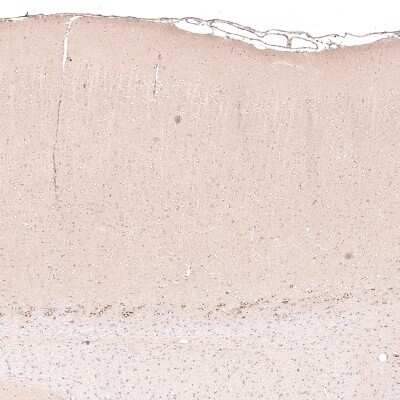 Immunohistochemistry-Paraffin: CTGF/CCN2 Antibody (CL5339) [NBP2-61415]