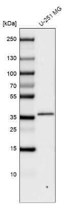 Western Blot: CTGF/CCN2 Antibody (CL5339) [NBP2-61415]