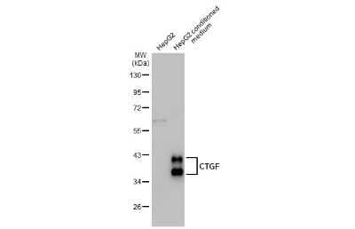 Western Blot: CTGF/CCN2 Antibody (28711) [NBP3-13686]