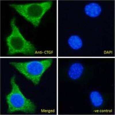 Immunocytochemistry/ Immunofluorescence: CTGF/CCN2 Antibody [NBP2-66426]