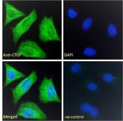 Immunocytochemistry/ Immunofluorescence: CTGF/CCN2 Antibody [NBP2-69990]