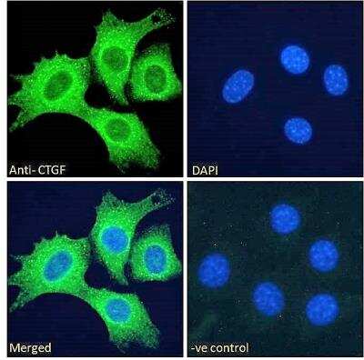 Immunocytochemistry/ Immunofluorescence: CTGF/CCN2 Antibody [NBP2-69990]