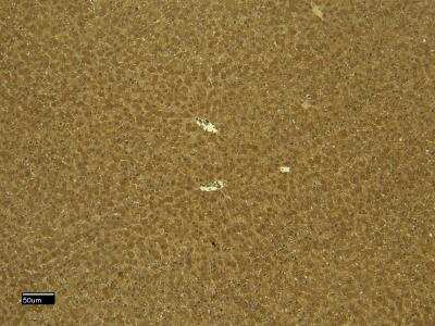 Immunohistochemistry: CTGF/CCN2 Antibody [NBP2-66426]