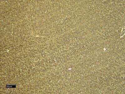 Immunohistochemistry: CTGF/CCN2 Antibody [NBP2-69990]