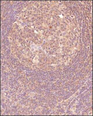 Immunohistochemistry-Paraffin: CTGF/CCN2 Antibody [NB100-724]