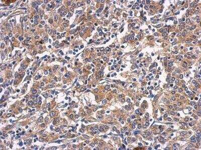 Immunohistochemistry-Paraffin: CTGF/CCN2 Antibody [NBP2-16025]