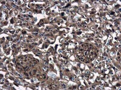 Immunohistochemistry-Paraffin: CTGF/CCN2 Antibody [NBP2-16026]