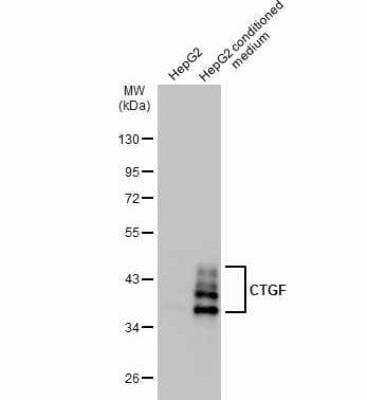 Western Blot: CTGF/CCN2 Antibody [NBP2-16025]