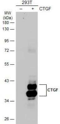 Western Blot: CTGF/CCN2 Antibody [NBP2-16025]