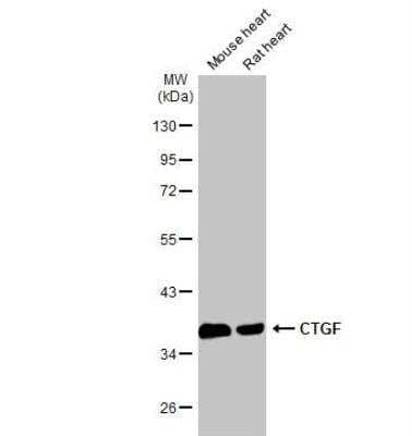 Western Blot: CTGF/CCN2 Antibody [NBP2-16025]