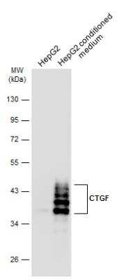Western Blot: CTGF/CCN2 Antibody [NBP2-16026]