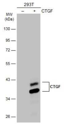 Western Blot: CTGF/CCN2 Antibody [NBP2-16026]