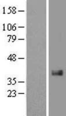 Western Blot: CTGF/CCN2 Overexpression Lysate [NBL1-09572]