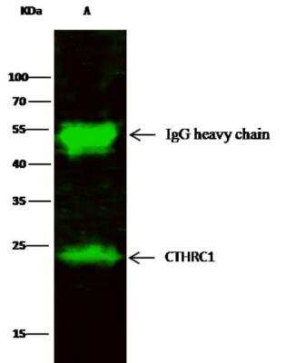 Immunoprecipitation: CTHRC1 Antibody (166) [NBP2-89947]