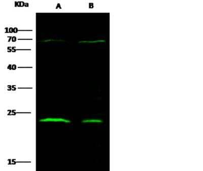 Western Blot: CTHRC1 Antibody (166) [NBP2-89947]