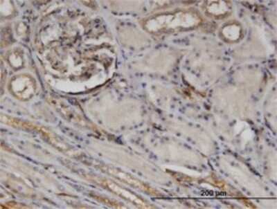 Immunohistochemistry-Paraffin: CTHRC1 Antibody (1G12) [H00115908-M05]