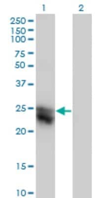 Western Blot: CTHRC1 Antibody (1G12) [H00115908-M05]