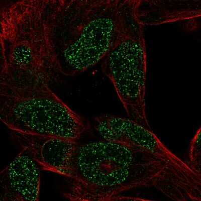 Immunocytochemistry/ Immunofluorescence: CTHRC1 Antibody [NBP2-57734]