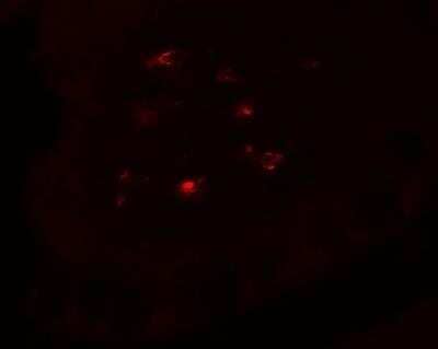 Immunocytochemistry/ Immunofluorescence: CTHRC1 Antibody - BSA Free [NBP2-81744]