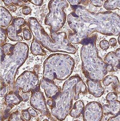 Immunohistochemistry-Paraffin: CTHRC1 Antibody [NBP2-31797]