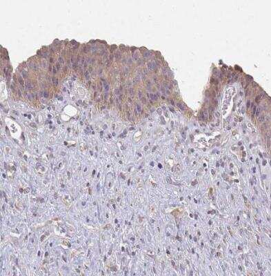 Immunohistochemistry-Paraffin: CTHRC1 Antibody [NBP2-31797]
