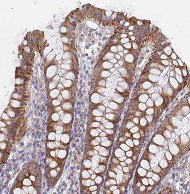 Immunohistochemistry-Paraffin: CTHRC1 Antibody [NBP2-31797]
