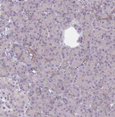 Immunohistochemistry-Paraffin: CTHRC1 Antibody [NBP2-31797]