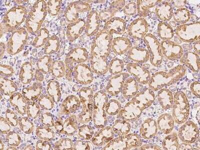 Immunohistochemistry-Paraffin: CTHRC1 Antibody [NBP2-98449]