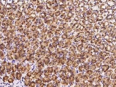 Immunohistochemistry-Paraffin: CTHRC1 Antibody [NBP2-98449]