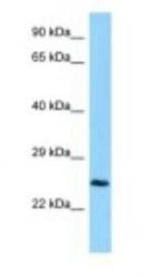 Western Blot: CTHRC1 Antibody [NBP1-98466]