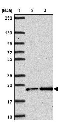 Western Blot: CTHRC1 Antibody [NBP2-31797]