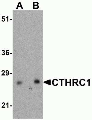 Western Blot: CTHRC1 AntibodyBSA Free [NBP2-81744]