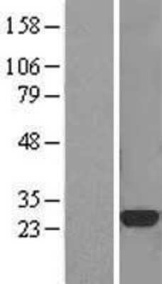 Western Blot: CTHRC1 Overexpression Lysate [NBL1-09574]