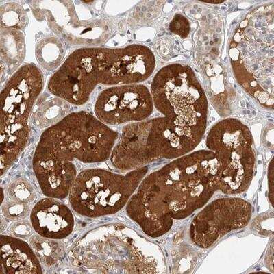 Immunohistochemistry-Paraffin: CTIF Antibody [NBP1-83008]