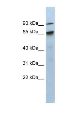 Western Blot: CTIF Antibody [NBP1-57319]