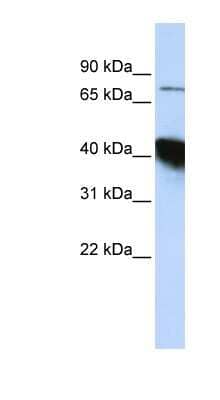 Western Blot: CTIF Antibody [NBP1-57423]