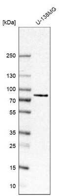 Western Blot: CTIF Antibody [NBP1-83007]