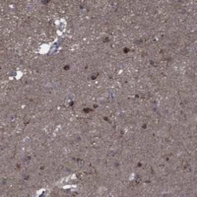 Immunohistochemistry-Paraffin: CTL1/SLC44A1 Antibody [NBP3-17824]