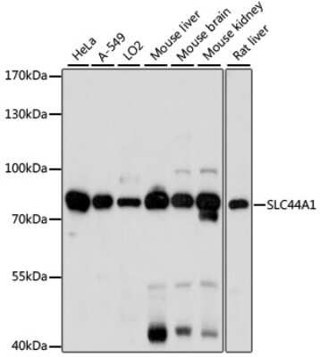 Western Blot: CTL1/SLC44A1 AntibodyAzide and BSA Free [NBP2-92231]