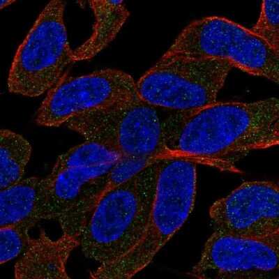 Immunocytochemistry/ Immunofluorescence: CTL5 Antibody [NBP2-30814]