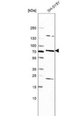 Western Blot: CTL5 Antibody [NBP2-30869]