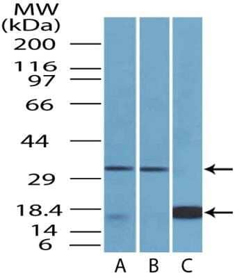 Western Blot: CTLA-4 Antibody (37B3D8.2F2)Azide and BSA Free [NBP2-80683]