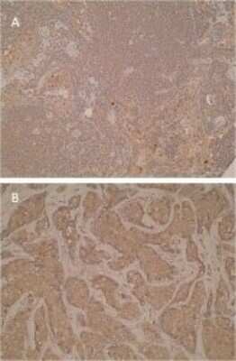 Immunohistochemistry-Paraffin: CTLA-4 Antibody (L4P2F5*F10) - BSA Free [NBP2-50286]