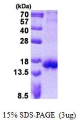 SDS-PAGE: Recombinant Human CTLA-4 His Protein [NBP2-22987]