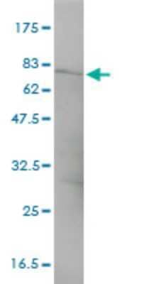 Western Blot: CTNNA3 Antibody (3F4-1B11) [H00029119-M01]