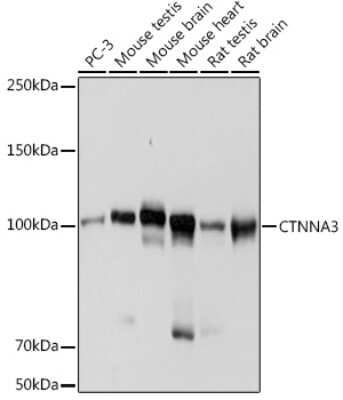 Western Blot: CTNNA3 Antibody (8F1U7) [NBP3-15741]