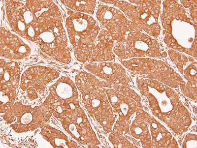 Immunohistochemistry-Paraffin: CTNNA3 Antibody [NBP2-16030]