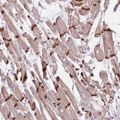 Immunohistochemistry-Paraffin: CTNNA3 Antibody [NBP2-49348]